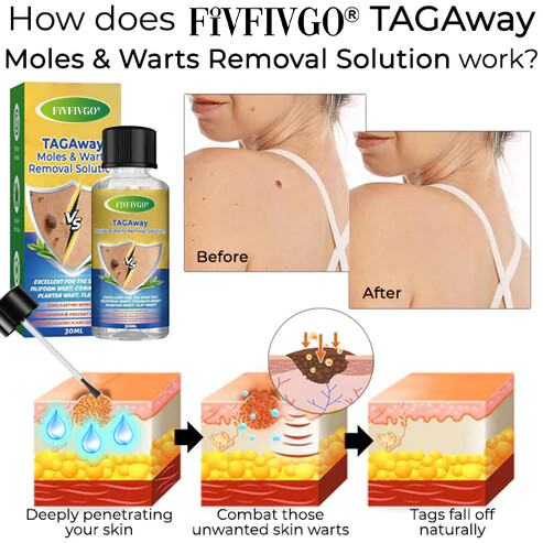 Fivfivgo® TAGAway Moles & Warts Removal Solution