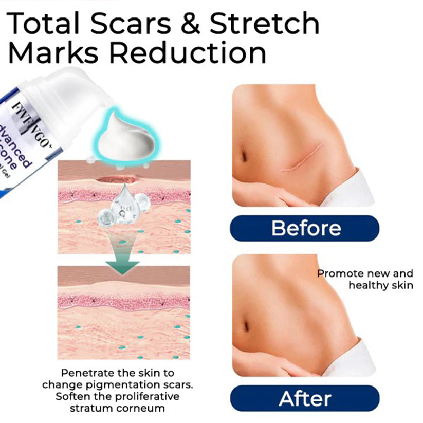 Fivfivgo® Advanced Silicone Scar Removal Gel