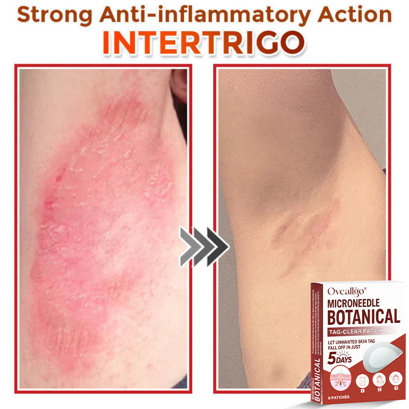 Oveallgo® MicroNeedle Botanical Tag-Clear Patch PRO 🇺🇸 Made in the USA