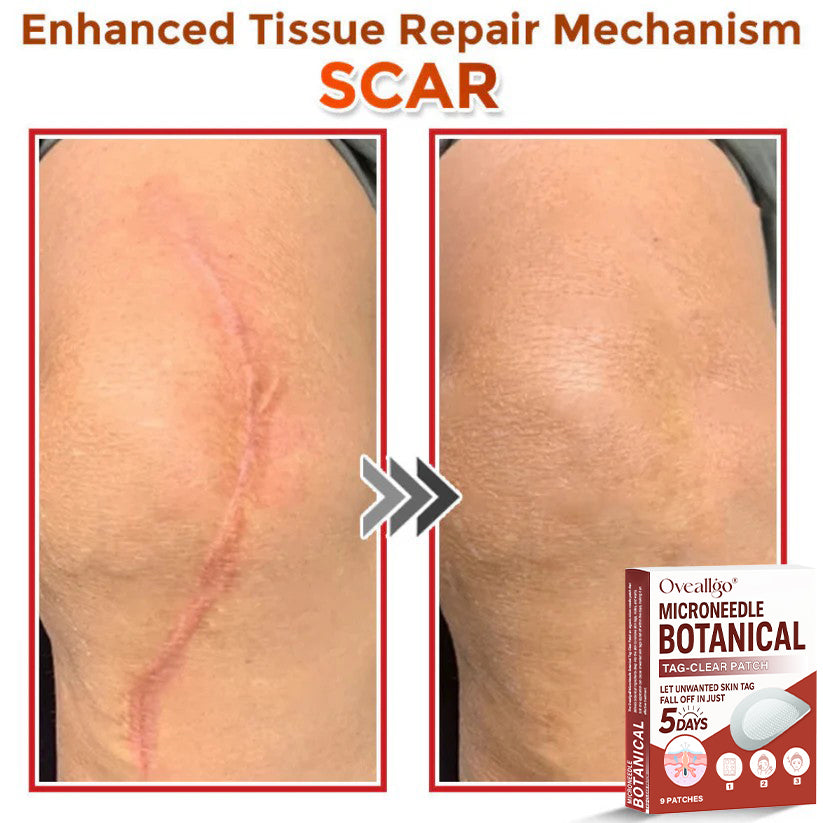 Oveallgo® MicroNeedle Botanical Tag-Clear Patch PRO 🇺🇸 Made in the USA