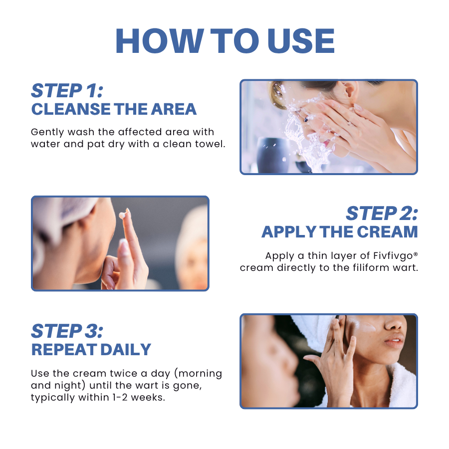 Fivfivgo® HPV Facial Filiform Warts Removal Cream 20 Fivfivgo® HPV Facial Filiform Warts Removal Cream