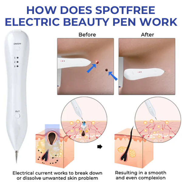 Oveallgo™ EX Spotfree ULTRA Professional Electric Cosmetic Pen