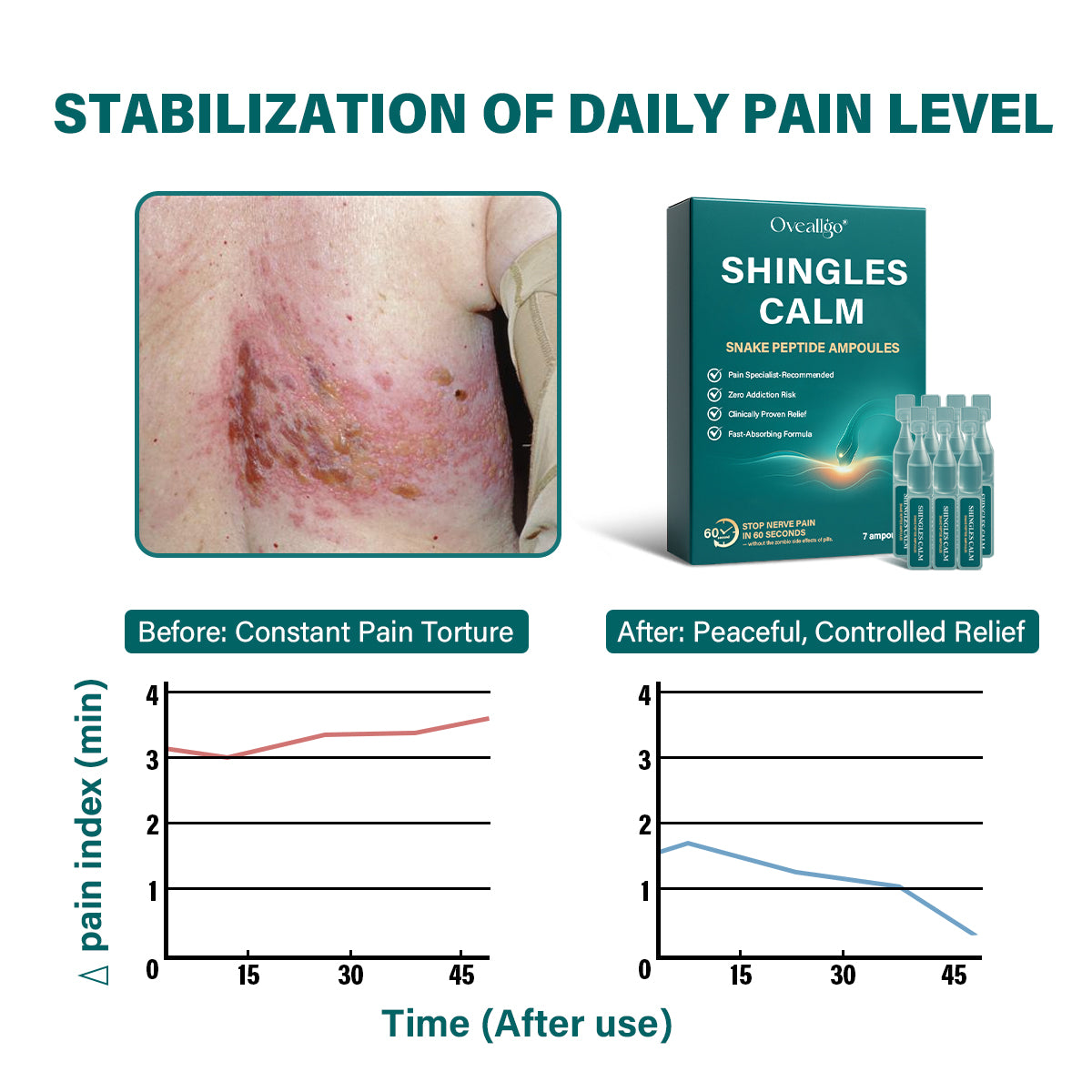 Oveallgo® Shingles Calm Snake Peptide Ampoules