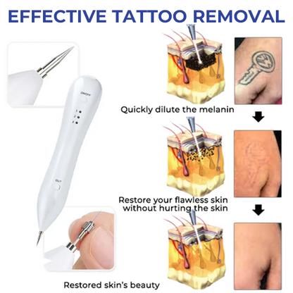 Oveallgo™ EX Spotfree ULTRA Professional Electric Cosmetic Pen