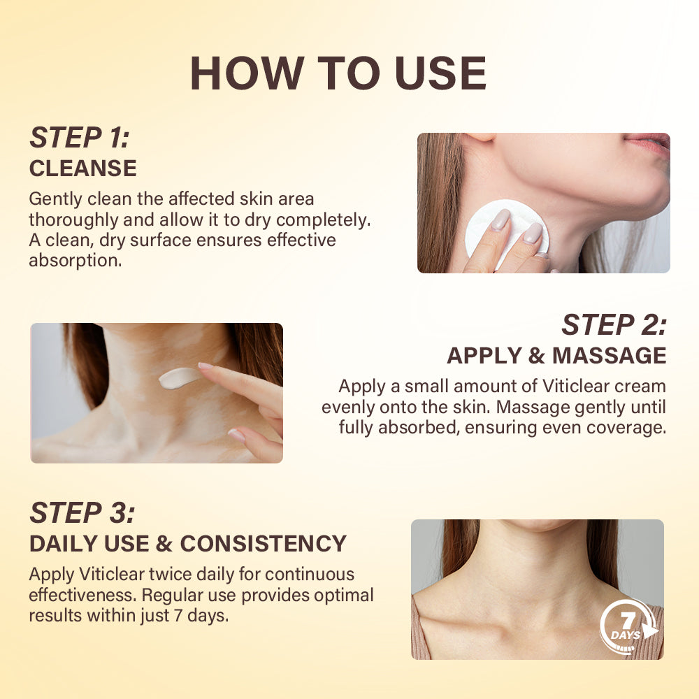 Oveallgo® VitiClear Bee Venom Cream Ultra 29 Oveallgo® VitiClear Bee Venom Cream Ultra