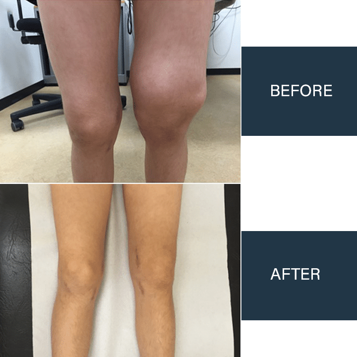 Oveallgo™ Jellyfish Collagen Joint Repair Cream