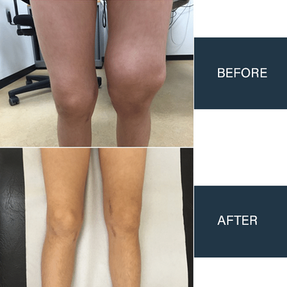 Oveallgo™ Jellyfish Collagen Joint Repair Cream
