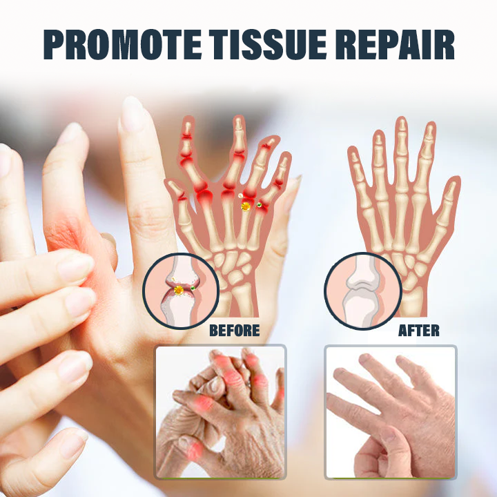 Oveallgo™ Jellyfish Collagen Joint Repair Cream