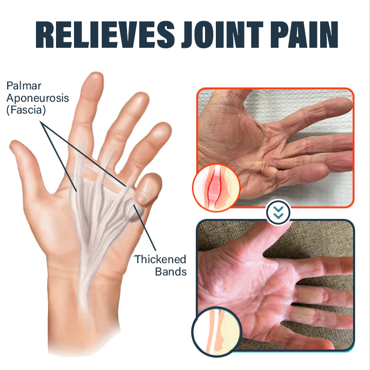 Oveallgo™ Jellyfish Collagen Joint Repair Cream