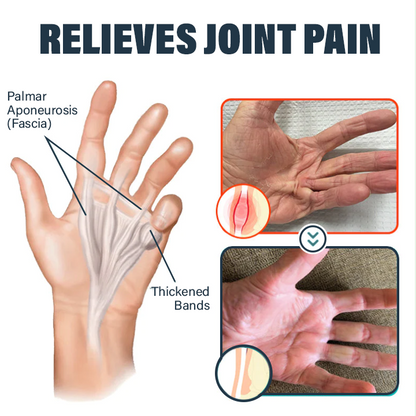 Oveallgo™ Jellyfish Collagen Joint Repair Cream