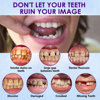🦷Oveallgo™ 𝑆𝑖𝑙𝑖𝑐𝑜𝑛𝑒 𝐷𝑒𝑛𝑡𝑢𝑟𝑒 𝑅𝑢𝑙𝑒𝑟 𝑆𝑒𝑡
