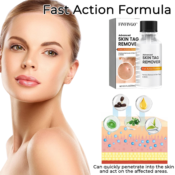 Fivfivgo® Advanced Skin Tag Remover - Fast Action Formula