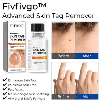 Fivfivgo® Advanced Skin Tag Remover - Fast Action Formula