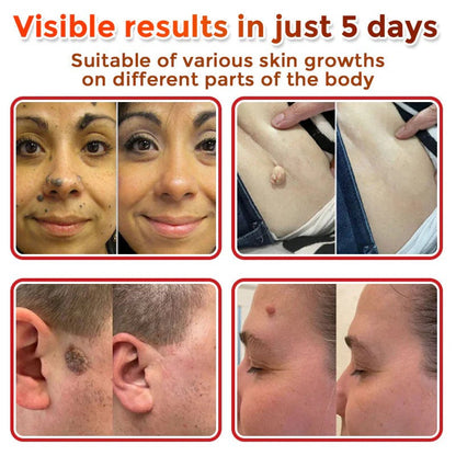 Oveallgo® MicroNeedle Botanical Tag-Clear Patch PRO 🇺🇸 Made in the USA