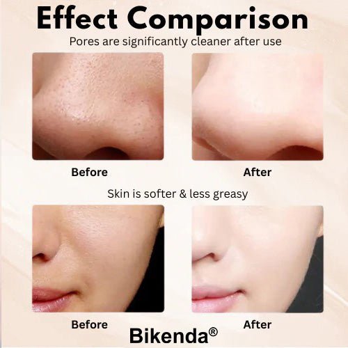 Bikenda® Ultrasonic Skin Spatula